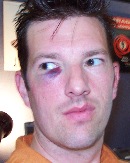 Shiner